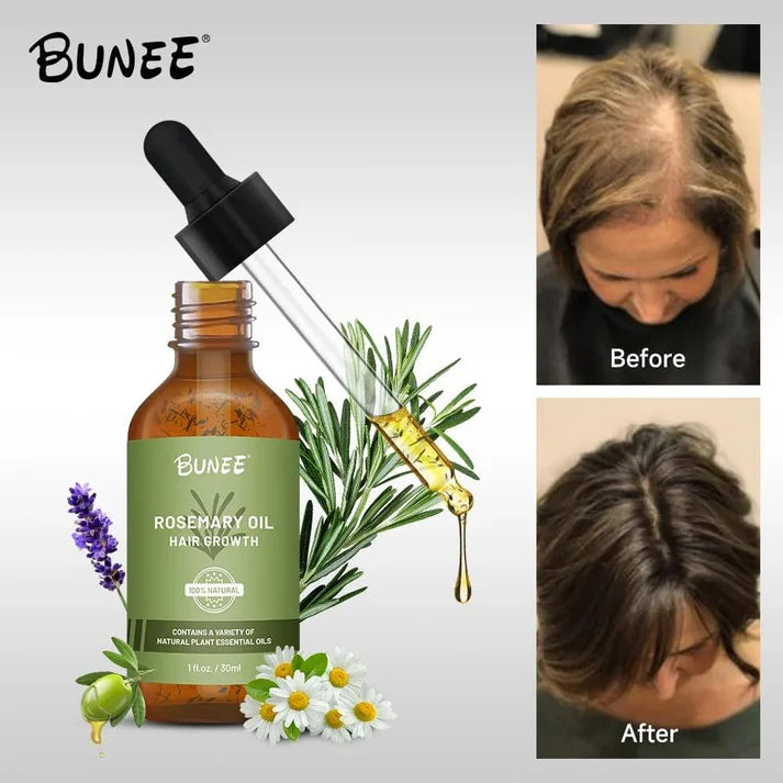 Rosemary Hair Growth Oil (Buy 1 ⚡Get 1 Free⚡)